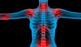 گلوکوزامین Aching_joints