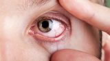دلیل درد چشم چیست؟