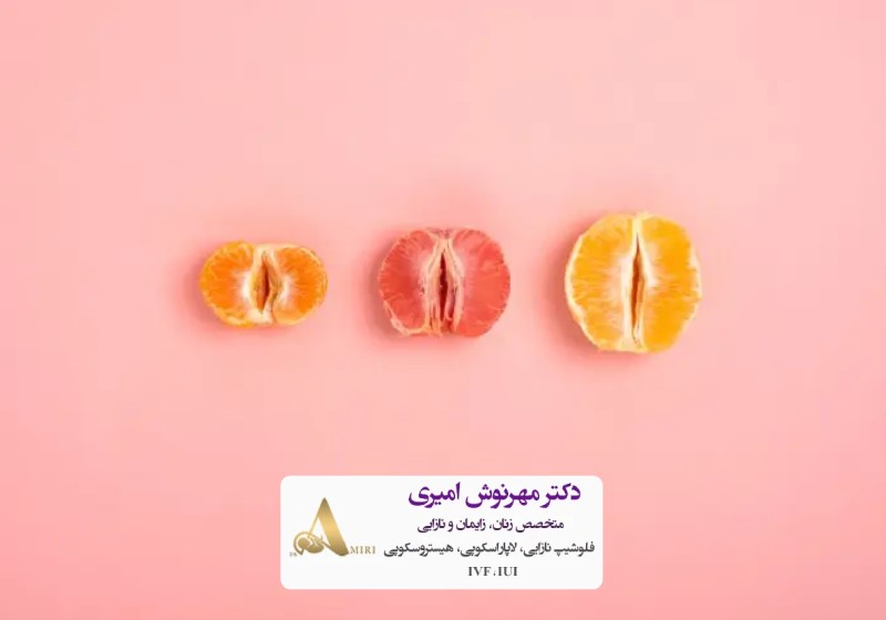 ماندگاری تزریق ژل به واژن چه قدر است؟