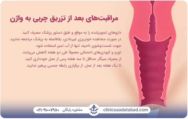 مراقبت‌های بعد از تزریق چربی به واژن