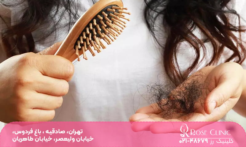 فردی که در داخل یک دستش برس است و دست دیگر موهایی که ریخته شده است