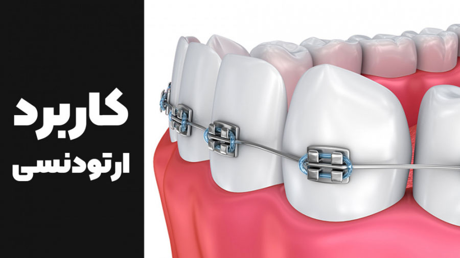 کاربرد ارتودنسی