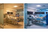 فرق ICU و CCU چیست؟ | راهنمای ساده تفاوت بخش‌های ویژه