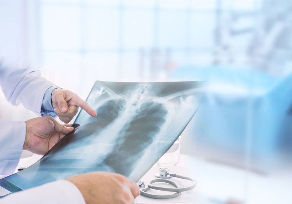 عفونت شدید ریه در سالمندان