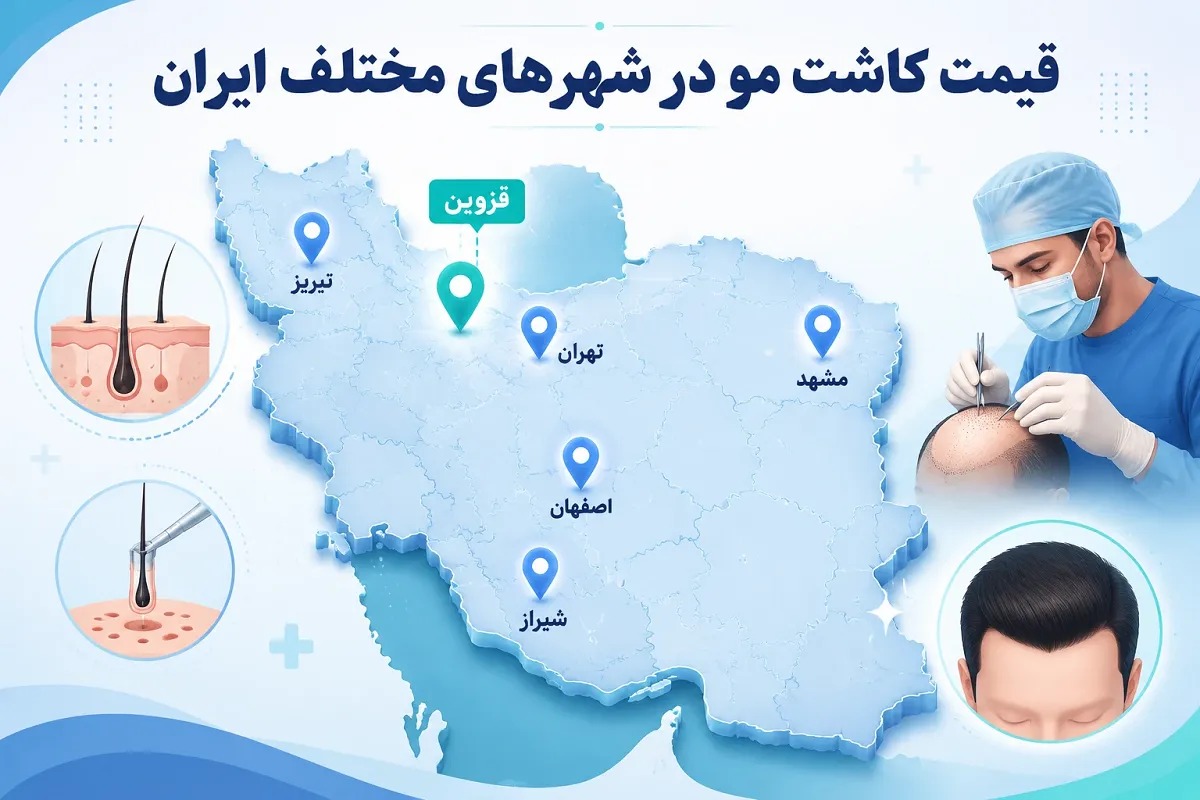 قیمت کاشت مو در 1405