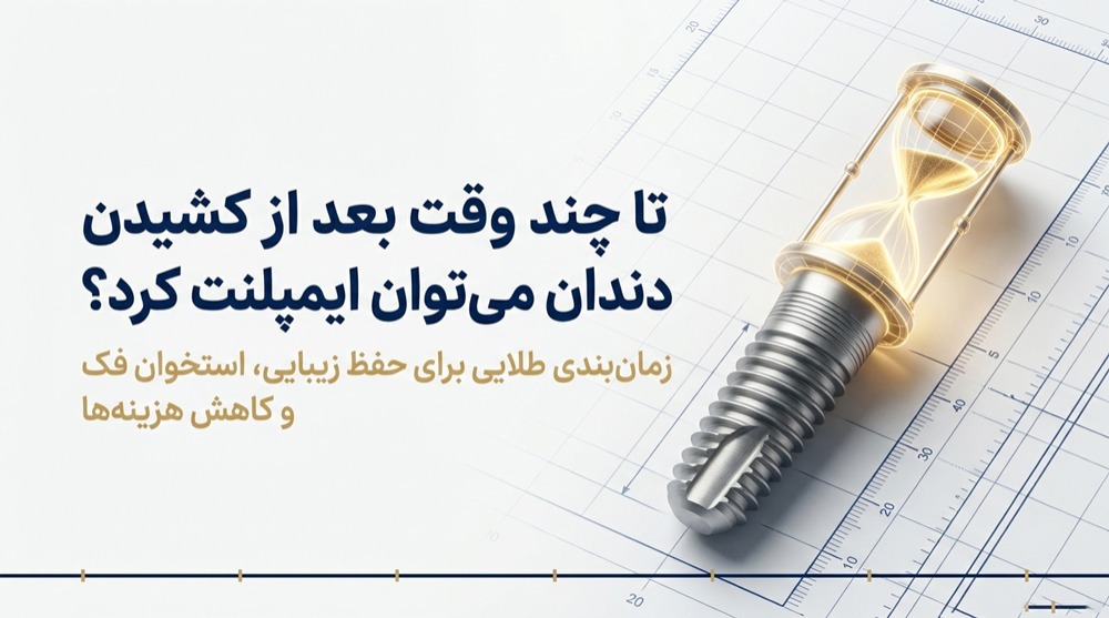 تا چند وقت بعد از کشیدن دندان می‌توان ایمپلنت کرد؟