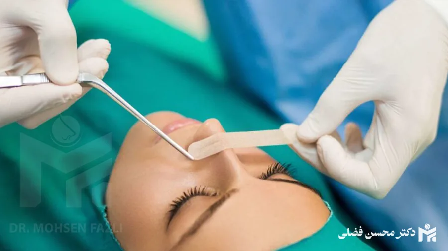 عمل انحراف بینی چگونه است؟ | دکتر محسن فضلی