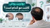 بهترین روش کاشت مو
