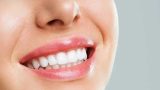 اصلاح طرح لبخند