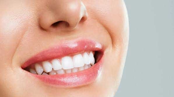 اصلاح طرح لبخند
