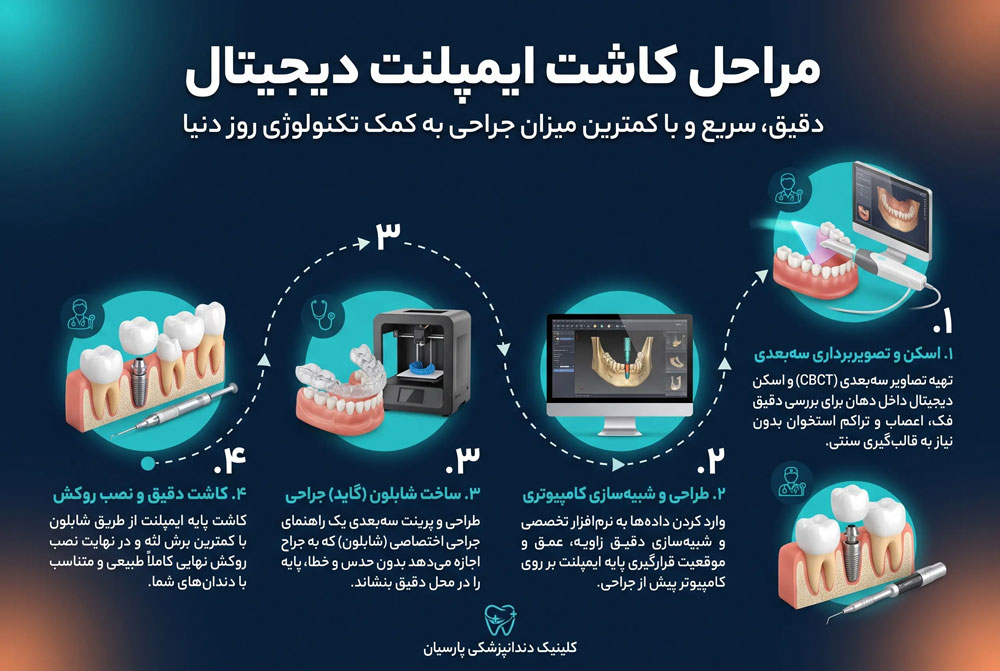 مراحل کاشت ایمپلنت دیجیتال با استفاده از برندهای معتبر و اورجینال در کلینیک دندانپزشکی پارسیان